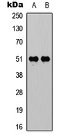 Vitamin D Receptor / VDR Antibody - Western blot analysis of VDR (pS208) expression in HeLa (A); HepG2 (B) whole cell lysates.