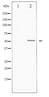 Vitamin D Receptor / VDR Antibody - Western blot of Vitamin D Receptor phosphorylation expression in heatshock treated HT29 whole cell lysates,The lane on the left is treated with the antigen-specific peptide.