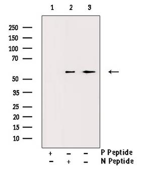 Vitamin D Receptor / VDR Antibody - Western blot analysis of Phospho-Vitamin D Receptor (Ser208) antibody expression in heatshock treated HT29 cells lysates. The lane on the right is treated with the antigen-specific peptide.