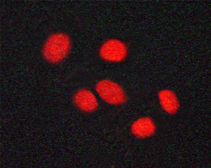 Vitamin D Receptor / VDR Antibody - Staining A549 cells by IF/ICC. The samples were fixed with PFA and permeabilized in 0.1% saponin prior to blocking in 10% serum for 45 min at 37°C. The primary antibody was diluted 1/400 and incubated with the sample for 1 hour at 37°C. A Alexa Fluor® 594 conjugated goat polyclonal to rabbit IgG (H+L), diluted 1/600 was used as secondary antibody.