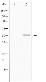 Vitamin D Receptor / VDR Antibody - Western blot analysis of Vitamin D Receptor phosphorylation expression in heatshock treated HT29 whole cells lysates. The lane on the left is treated with the antigen-specific peptide.