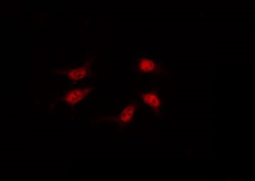 Vitamin D Receptor / VDR Antibody - Staining HT29 cells by IF/ICC. The samples were fixed with PFA and permeabilized in 0.1% Triton X-100, then blocked in 10% serum for 45 min at 25°C. The primary antibody was diluted at 1:200 and incubated with the sample for 1 hour at 37°C. An Alexa Fluor 594 conjugated goat anti-rabbit IgG (H+L) Ab, diluted at 1/600, was used as the secondary antibody.