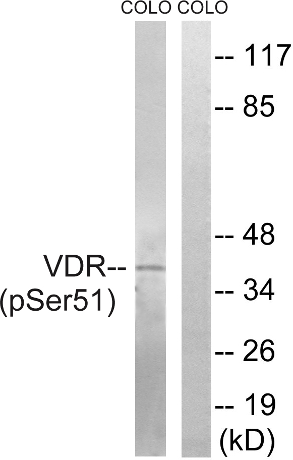 Vitamin D Receptor / VDR Antibody - Western blot analysis of lysates from COLO205 cells treated with Insulin 0.01U/ml 15', using Vitamin D3 Receptor (Phospho-Ser51) Antibody. The lane on the right is blocked with the phospho peptide.