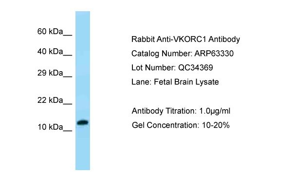 VKORC1 Antibody -  This image was taken for the unconjugated form of this product. Other forms have not been tested.