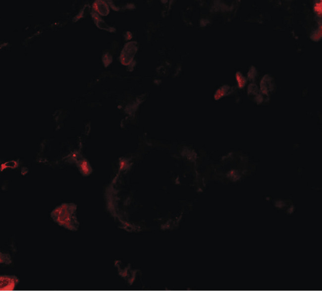 VKORC1 Antibody - Immunofluorescence of VKORC1 in human lung tissue with VKORC1 antibody at 20 ug/ml.