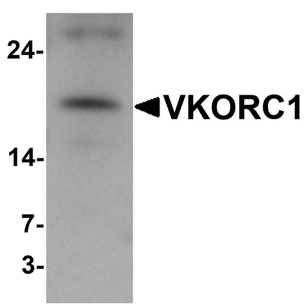 VKORC1 Antibody - Western blot analysis of VKORC1 in A549 cell lysate with VKORC1 antibody at 1 ug/ml.