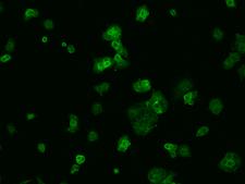 VKORC1 Antibody - Immunofluorescence staining of VKORC1 in MCF7 cells. Cells were fixed with 4% PFA, permeabilzed with 0.1% Triton X-100 in PBS, blocked with 10% serum, and incubated with rabbit anti-Human VKORC1 polyclonal antibody (dilution ratio 1:200) at 4°C overnight. Then cells were stained with the Alexa Fluor 488-conjugated Goat Anti-rabbit IgG secondary antibody (green). Positive staining was localized to Cytoplasm.