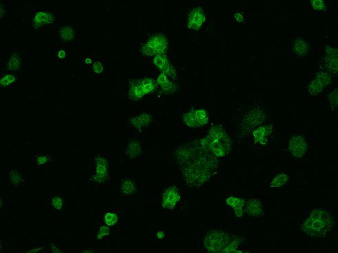 VKORC1 Antibody - Immunofluorescence staining of VKORC1 in MCF7 cells. Cells were fixed with 4% PFA, permeabilzed with 0.1% Triton X-100 in PBS, blocked with 10% serum, and incubated with rabbit anti-Human VKORC1 polyclonal antibody (dilution ratio 1:200) at 4°C overnight. Then cells were stained with the Alexa Fluor 488-conjugated Goat Anti-rabbit IgG secondary antibody (green). Positive staining was localized to Cytoplasm.