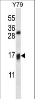 VKORC1L1 Antibody - VKORC1L1 Antibody western blot of Y79 cell line lysates (35 ug/lane). The VKORC1L1 antibody detected the VKORC1L1 protein (arrow).