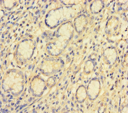 VKORC1L1 Antibody - Immunohistochemistry of paraffin-embedded human stomach tissue using VKORC1L1 Antibody at dilution of 1:100