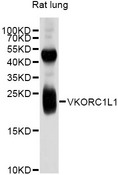VKORC1L1 Antibody - Western blot analysis of extracts of rat lung, using VKORC1L1 antibody at 1:1000 dilution. The secondary antibody used was an HRP Goat Anti-Rat IgG (H+L) (AS028) at 1:10000 dilution. Lysates were loaded 25ug per lane and 3% nonfat dry milk in TBST was used for blocking. An ECL Kit was used for detection and the exposure time was 10s.