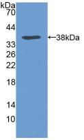 VLDLR Antibody - Western Blot; Sample: Recombinant VLDLR, Human.
