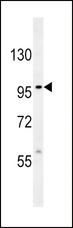 VLDLR Antibody - VLDLR Antibody western blot of 293 cell line lysates (35 ug/lane). The VLDLR antibody detected the VLDLR protein (arrow).
