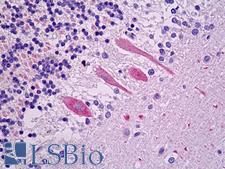 VLDLR Antibody - Anti-VLDLR antibody IHC of human brain, cerebellum, Purkinje. Immunohistochemistry of formalin-fixed, paraffin-embedded tissue after heat-induced antigen retrieval. Antibody dilution 1:50.