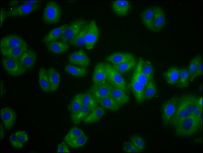 VLDLR Antibody - Immunofluorescence staining of HepG2 cells diluted at 1:100, counter-stained with DAPI. The cells were fixed in 4% formaldehyde, permeabilized using 0.2% Triton X-100 and blocked in 10% normal Goat Serum. The cells were then incubated with the antibody overnight at 4°C.The Secondary antibody was Alexa Fluor 488-congugated AffiniPure Goat Anti-Rabbit IgG (H+L).