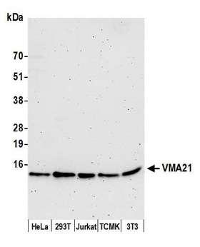 VMA21 / XMEA Antibody - Detection of human and mouse VMA21 by western blot. Samples: Whole cell lysate (15 µg) from HeLa, HEK293T, Jurkat, mouse TCMK-1, and mouse NIH 3T3 cells prepared using NETN lysis buffer. Antibody: Affinity purified rabbit anti-VMA21 antibody used for WB at 1:1000. Detection: Chemiluminescence with an exposure time of 3 minutes.