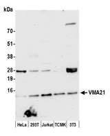 VMA21 / XMEA Antibody - Detection of human and mouse VMA21 by western blot. Samples: Whole cell lysate (15 µg) from HeLa, HEK293T, Jurkat, mouse TCMK-1, and mouse NIH 3T3 cells prepared using NETN lysis buffer. Antibody: Affinity purified rabbit anti-VMA21 antibody used for WB at 1:1000. Detection: Chemiluminescence with an exposure time of 30 seconds.