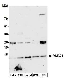 VMA21 / XMEA Antibody - Detection of human and mouse VMA21 by western blot. Samples: Whole cell lysate (15 µg) from HeLa, HEK293T, Jurkat, mouse TCMK-1, and mouse NIH 3T3 cells prepared using NETN lysis buffer. Antibody: Affinity purified rabbit anti-VMA21 antibody used for WB at 1:1000. Detection: Chemiluminescence with an exposure time of 30 seconds.