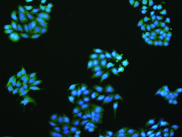VMA21 / XMEA Antibody - The image is immunofluorescence of HepG2 cell  using VMA21 Polyclonal Antibody at dilution of 1:50.