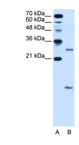 VMA21 / XMEA Antibody - VMA21 antibody ARP44721_T100-NP_001017980-LOC203547(hypothetical protein LOC203547) Antibody Western blot of HepG2 cell lysate.  This image was taken for the unconjugated form of this product. Other forms have not been tested.