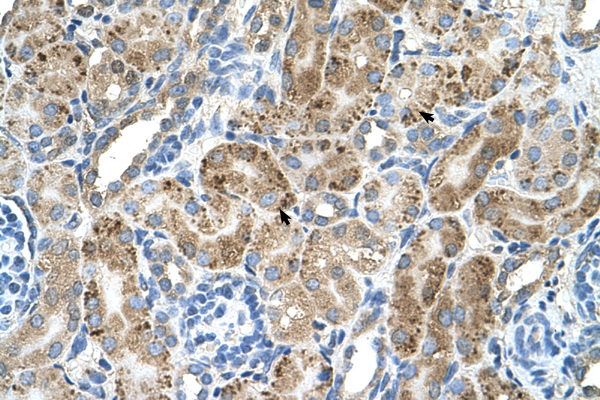 VMA21 / XMEA Antibody - VMA21 antibody ARP44721_T100-NP_001017980-LOC203547(hypothetical protein LOC203547) Antibody IHC of formalin-fixed, paraffin-embedded human Kidney. Positive label: Epithelial cells of renal tubule indicated with arrows. Antibody concentration 4-8 ug/ml. Magnification 400X.  This image was taken for the unconjugated form of this product. Other forms have not been tested.