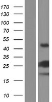 VMAC Protein - Western validation with an anti-DDK antibody * L: Control HEK293 lysate R: Over-expression lysate