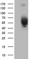 VMD2L3 / BEST3 Antibody - HEK293T cells were transfected with the pCMV6-ENTRY control (Left lane) or pCMV6-ENTRY BEST3 (Right lane) cDNA for 48 hrs and lysed. Equivalent amounts of cell lysates (5 ug per lane) were separated by SDS-PAGE and immunoblotted with anti-BEST3.