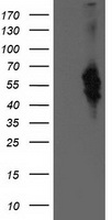VMD2L3 / BEST3 Antibody - HEK293T cells were transfected with the pCMV6-ENTRY control (Left lane) or pCMV6-ENTRY BEST3 (Right lane) cDNA for 48 hrs and lysed. Equivalent amounts of cell lysates (5 ug per lane) were separated by SDS-PAGE and immunoblotted with anti-BEST3.