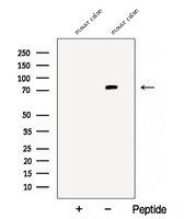 VMD2L3 / BEST3 Antibody - Western blot analysis of extracts of mouse colon tissue using Bestrophin-3 antibody. The lane on the left was treated with blocking peptide.