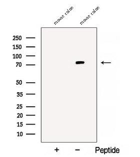 VMD2L3 / BEST3 Antibody - Western blot analysis of extracts of mouse colon tissue using Bestrophin-3 antibody. The lane on the left was treated with blocking peptide.