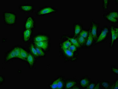 VMO1 Antibody - Immunofluorescent analysis of Hela cells using VMO1 Antibody at dilution of 1:100 and Alexa Fluor 488-congugated AffiniPure Goat Anti-Rabbit IgG(H+L)