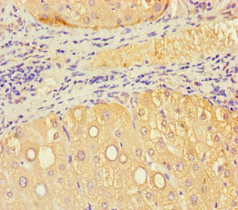 VMO1 Antibody - Immunohistochemistry of paraffin-embedded human liver tissue using VMO1 Antibody at dilution of 1:100