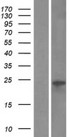 VMO1 Protein - Western validation with an anti-DDK antibody * L: Control HEK293 lysate R: Over-expression lysate