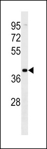 VN1R2 Antibody - VN1R2 Antibody western blot of MDA-MB453 cell line lysates (35 ug/lane). The VN1R2 Antibody detected the VN1R2 protein (arrow).