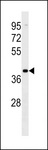 VN1R2 Antibody - VN1R2 Antibody western blot of MDA-MB453 cell line lysates (35 ug/lane). The VN1R2 Antibody detected the VN1R2 protein (arrow).