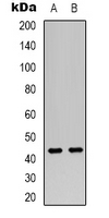 VN1R2 Antibody - Western blot analysis of VN1R2 expression in MCF7 (A); HUVEC (B) whole cell lysates.