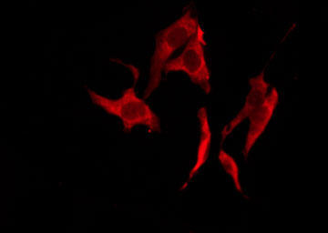 VN1R2 Antibody - Staining HuvEc cells by IF/ICC. The samples were fixed with PFA and permeabilized in 0.1% Triton X-100, then blocked in 10% serum for 45 min at 25°C. The primary antibody was diluted at 1:200 and incubated with the sample for 1 hour at 37°C. An Alexa Fluor 594 conjugated goat anti-rabbit IgG (H+L) Ab, diluted at 1/600, was used as the secondary antibody.