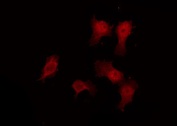 VN1R3 Antibody - Staining HuvEc cells by IF/ICC. The samples were fixed with PFA and permeabilized in 0.1% Triton X-100, then blocked in 10% serum for 45 min at 25°C. The primary antibody was diluted at 1:200 and incubated with the sample for 1 hour at 37°C. An Alexa Fluor 594 conjugated goat anti-rabbit IgG (H+L) Ab, diluted at 1/600, was used as the secondary antibody.