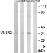 VN1R3 Antibody - Western blot analysis of extracts from HeLa cells, COLO cells and HUVEC cells, using VN1R3 antibody.