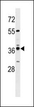 VN1R4 Antibody - VN1R4 Antibody western blot of MDA-MB231 cell line lysates (35 ug/lane). The VN1R4 antibody detected the VN1R4 protein (arrow).