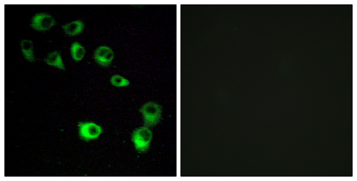 VN1R4 Antibody - Immunofluorescence analysis of MCF7 cells, using VN1R4 Antibody. The picture on the right is blocked with the synthesized peptide.