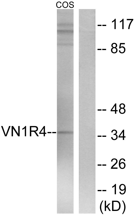 VN1R4 Antibody - Western blot analysis of lysates from COS7 cells, using VN1R4 Antibody. The lane on the right is blocked with the synthesized peptide.