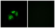 VN1R5 Antibody - Immunofluorescence analysis of A549 cells, using VN1R5 Antibody. The picture on the right is blocked with the synthesized peptide.