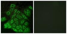 VN2R1P Antibody - Immunofluorescence analysis of A549 cells, using CSRL1 Antibody. The picture on the right is blocked with the synthesized peptide.