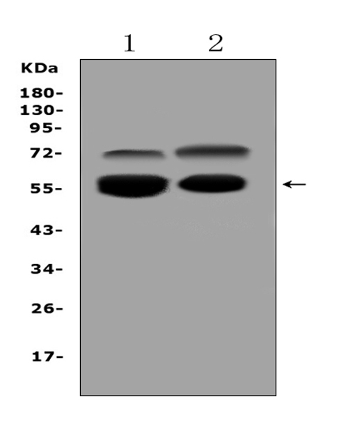 VNN1 Antibody - Western blot analysis of VNN1 expression in SKOV3 whole cell lysates and HELA whole cell lysates. VNN1 at 57KD was detected using rabbit anti-VNN1 Antigen Affinity purified polyclonal antibody at 0.5 ug/ml. The blot was developed using chemiluminescence (ECL) method.