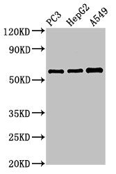 VNN1 Antibody - Positive Western Blot detected in PC3 whole cell lysate, HepG2 whole cell lysate, A549 whole cell lysate. All lanes: vnn1 antibody at 3.4 µg/ml Secondary Goat polyclonal to rabbit IgG at 1/50000 dilution. Predicted band size: 58 KDa. Observed band size: 58 KDa