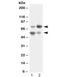 VNN1 Antibody - Western blot testing of human 1) SKOV3 and 2) HeLa lysate with VNN1 antibody at 0.5ug/ml. Expected molecular weight: ~56 kDa (unmodified) and ~70 kDa (glycosylated).