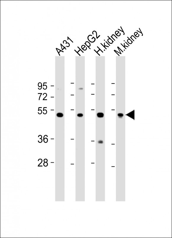 VNN1 Antibody - All lanes: Anti-VNN1 Antibody (N-Term) at 1:2000 dilution Lane 1: A431 whole cell lysate Lane 2: HepG2 whole cell lysate Lane 3: human kidney lysate Lane 4: mouse kidney lysate Lysates/proteins at 20 µg per lane. Secondary Goat Anti-Rabbit IgG, (H+L), Peroxidase conjugated at 1/10000 dilution. Predicted band size: 57 kDa Blocking/Dilution buffer: 5% NFDM/TBST.