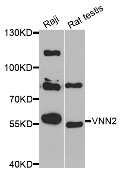 VNN2 Antibody - Western blot analysis of extracts of various cell lines.