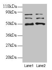 VOPP1 / ECOP Antibody - Western blot All lanes: Vesicular, overexpressed in cancer, prosurvival protein 1 antibody at 2µg/ml Lane 1: EC109 whole cell lysate Lane 2: 293T whole cell lysate Secondary Goat polyclonal to rabbit IgG at 1/15000 dilution Predicted band size: 20, 19, 18 kDa Observed band size: 50, 70, 80 kDa